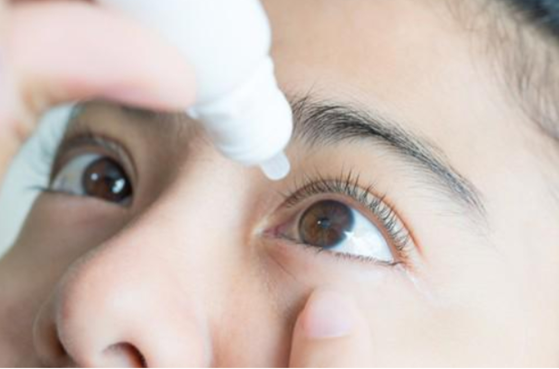 Giữ vệ sinh mắt giúp kiểm soát bệnh đau mắt đỏ hiệu quả