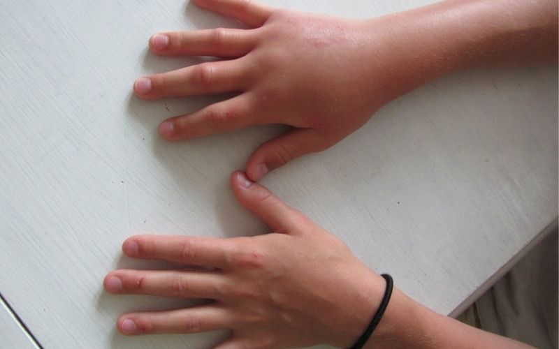 Tay chân sưng phù hoặc khó thở nhẹ là dấu hiệu cảnh báo thận đang “kêu cứu”